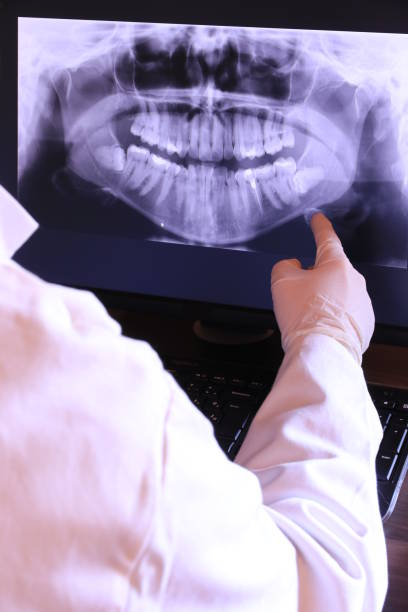 Best Broken Tooth Emergency  in Vilge St George, LA