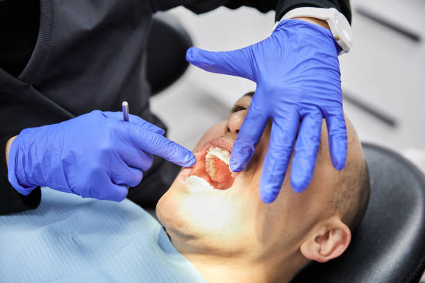 Best Emergency Tooth Extraction  in Vilge St George, LA